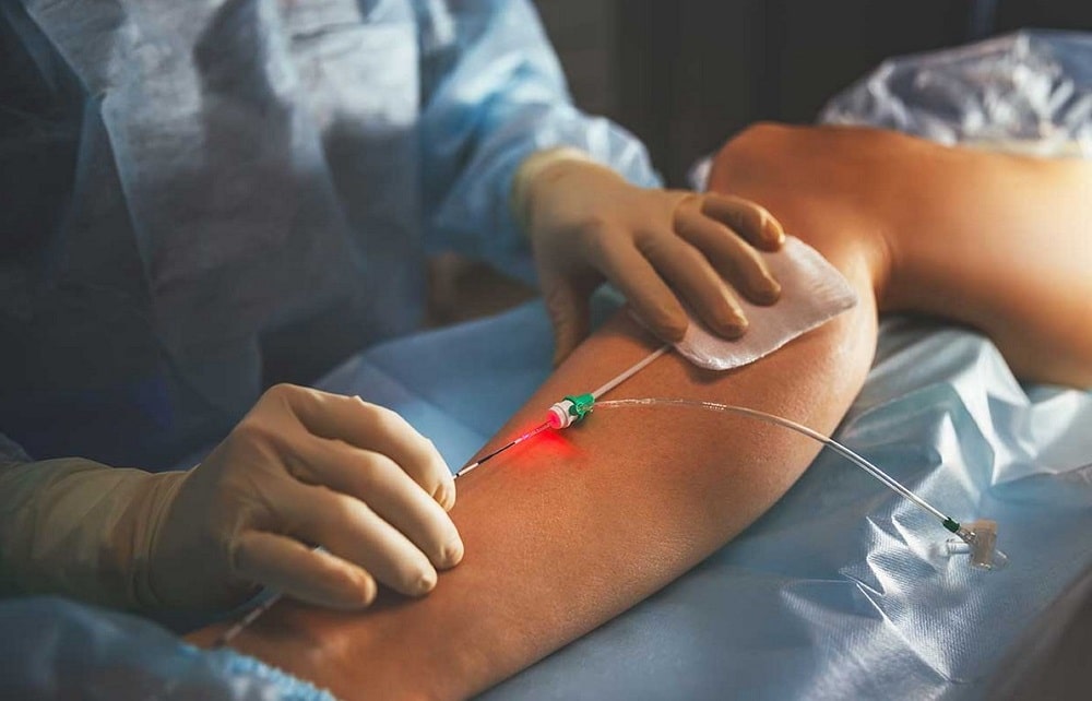 Purulent surgery and surgical complications of diabetes mellitus