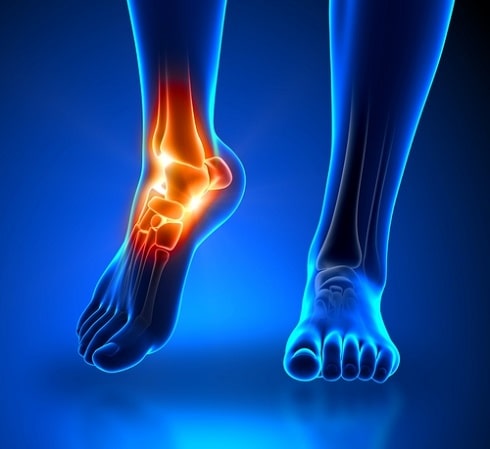 Department of bone-purulent surgery and consequences of trauma