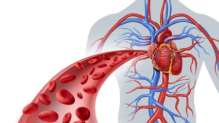 Vascular surgery